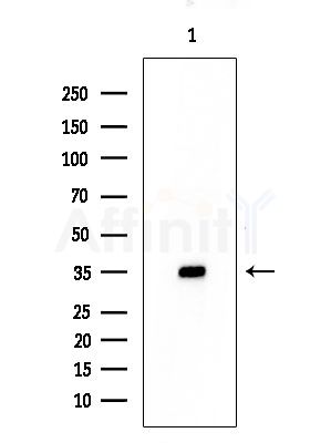 MMTAG2 Antibody - Western blot analysis of extracts from COLO205 cells, using MMTAG2 Antibody at 1/1000 dilution.
