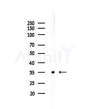 MMTAG2 Antibody - Western blot analysis of lysates from COLO205 cells, using MMTAG2 Antibody at 1/1000 dilution.