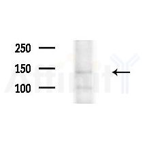 AN30A Antibody - Western blot analysis of extracts from PC12 cells, using AN30A Antibody at 1/1000 dilution.