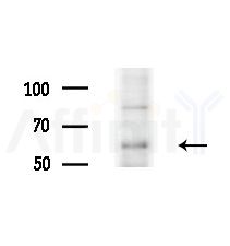 YTHDF1 Antibody - Western blot analysis of extracts from HepG2 cells(UV treatment), using YTHDF1 Antibody at 1/1000 dilution.