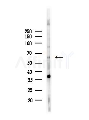 YTHDF1 Antibody - Western blot analysis of lysates from HepG2 cells(UV,30min treatment), using YTHDF1 Antibody at 1/1000 dilution.