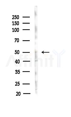 ZNF436 Antibody - Western blot analysis of lysates from MDA-MB-231 cells(heat-shock,45min treatment), using ZNF436 Antibody at 1/1000 dilution.