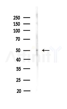 ZNF436 Antibody - Western blot analysis of lysates from Hela cells(heat-shock,45min treatment), using ZNF436 Antibody at 1/1000 dilution.