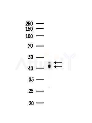 ILKAP Antibody - Western blot analysis of lysates from Hela cells(starvation,24h treatment), using ILKAP Antibody at 1/1000 dilution.