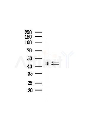 ILKAP Antibody - Western blot analysis of lysates from LoVo cells(heat-shock,45min treatment), using ILKAP Antibody at 1/1000 dilution.