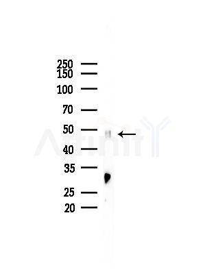 ILKAP Antibody - Western blot analysis of lysates from Rat lung, using ILKAP Antibody at 1/1000 dilution.