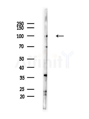 XRN2 Antibody - Western blot analysis of lysates from A375 cells(heat-shock,45min treatment), using XRN2 Antibody at 1/1000 dilution.