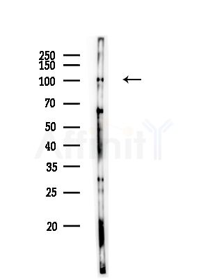 XRN2 Antibody - Western blot analysis of lysates from PC12 cells, using XRN2 Antibody at 1/1000 dilution.