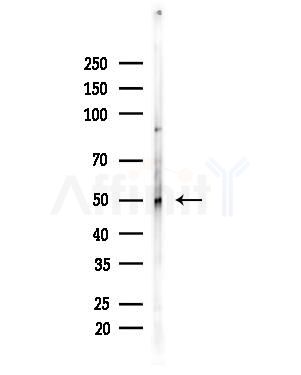 MUC13 Antibody - Western blot analysis of lysates from Hela cells(heat-shock,45min treatment), using MUC13 Antibody at 1/1000 dilution.