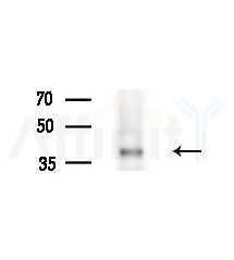 ZNF435 Antibody - Western blot analysis of extracts from B16F10-LUC cells(starvation treatment), using ZNF435 Antibody at 1/1000 dilution.