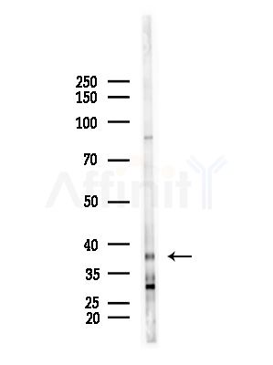ZNF435 Antibody - Western blot analysis of lysates from B16F10-LUC cells(starvation,24h treatment), using ZNF435 Antibody at 1/1000 dilution.
