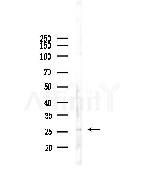 BRMS1 Antibody - Western blot analysis of lysates from COLO205 cells(UV,30min treatment), using BRMS1 Antibody at 1/1000 dilution.