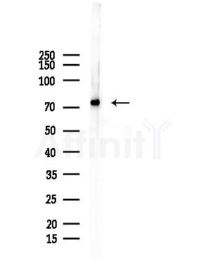 DCP1A Antibody - Western blot analysis of lysates from Rat testis, using DCP1A Antibody at 1/1000 dilution.