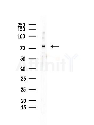DCP1A Antibody - Western blot analysis of lysates from EC304 cells, using DCP1A Antibody at 1/1000 dilution.