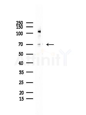 DCP1A Antibody - Western blot analysis of lysates from COLO205 cells, using DCP1A Antibody at 1/1000 dilution.