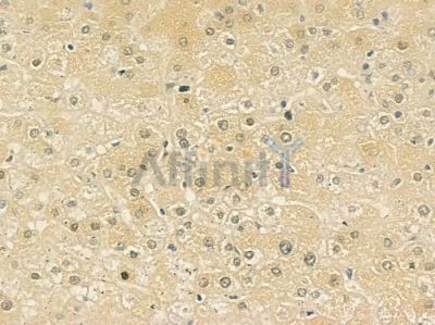 BCA3 Antibody - DF3444 at 1/100 staining human normal liver tissue by IHC-P.