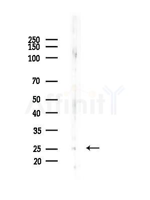 BCA3 Antibody - Western blot analysis of lysates from EC304 cells(heat-shock,45min treatment), using BCA3 Antibody at 1/1000 dilution.