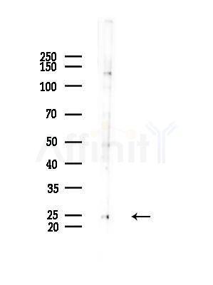 BCA3 Antibody - Western blot analysis of lysates from HUVEC cells(starvation,24h treatment), using BCA3 Antibody at 1/1000 dilution.