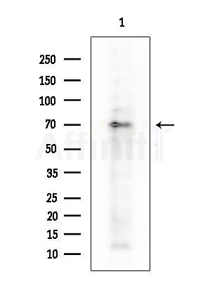 AATF Antibody - Western blot analysis of extracts from COLO205 cells, using AATF Antibody at 1/1000 dilution.
