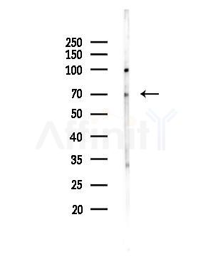 AATF Antibody - Western blot analysis of lysates from COLO205 cells, using AATF Antibody at 1/1000 dilution.