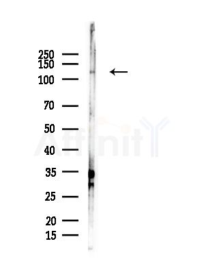 PERK Antibody - Western blot analysis of lysates from COLO205 cells, using PERK Antibody at 1/1000 dilution.