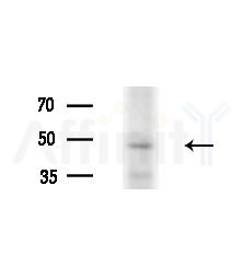LW-1 Antibody - Western blot analysis of extracts from HepG2 cells(UV treatment), using LW-1 Antibody at 1/1000 dilution.