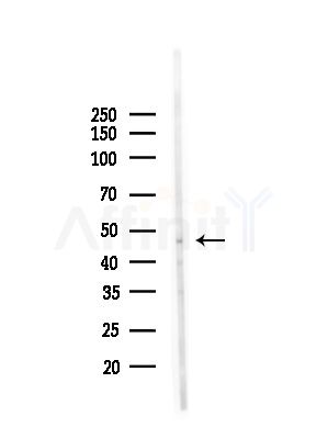 LW-1 Antibody - Western blot analysis of lysates from HepG2 cells(UV,30min treatment), using LW-1 Antibody at 1/1000 dilution.