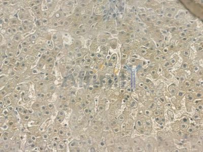 CARKL Antibody - DF3468 at 1/100 staining human normal liver tissue by IHC-P.