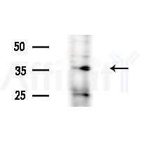 CNOT7 Antibody - Western blot analysis of extracts from PC12 cells, using CNOT7 Antibody at 1/1000 dilution.