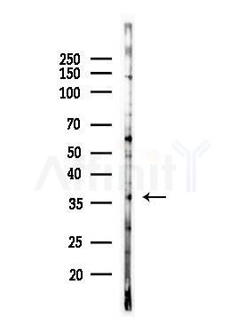 CNOT7 Antibody - Western blot analysis of lysates from PC12 cells(LPS, 4h treatment), using CNOT7 Antibody at 1/1000 dilution.