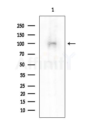 CDK11 Antibody - Western blot analysis of extracts from HUVEC cells, using CDK11 Antibody at 1/1000 dilution.