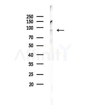 CDK11 Antibody - Western blot analysis of lysates from HUVEC cells, using CDK11 Antibody at 1/1000 dilution.