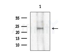 ASF1A Antibody - Western blot analysis of extracts from COLO205 cells, using ASF1A Antibody at 1/1000 dilution.