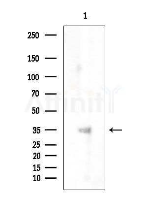 ATF5 Antibody - Western blot analysis of extracts from EC304 cells, using ATF5 Antibody at 1/1000 dilution.