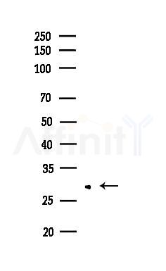 ATF5 Antibody - Western blot analysis of lysates from EC304 cells, using ATF5 Antibody at 1/1000 dilution.