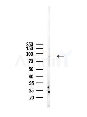 AKAP2 Antibody - Western blot analysis of lysates from RAW264.