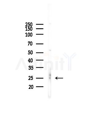 EID1 Antibody - Western blot analysis of lysates from COLO205 cells(UV,30min treatment), using EID1 Antibody at 1/1000 dilution.