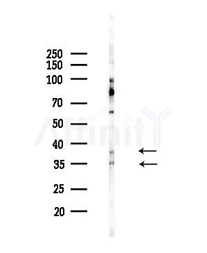 5HT1F Receptor Antibody - Western blot analysis of lysates from Hela cells(starvation,24h treatment), using 5HT1F Receptor Antibody at 1/1000 dilution.