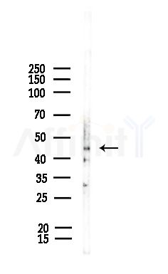 5HT6 Receptor Antibody - Western blot analysis of lysates from Rat liver, using 5HT6 Receptor Antibody at 1/1000 dilution.