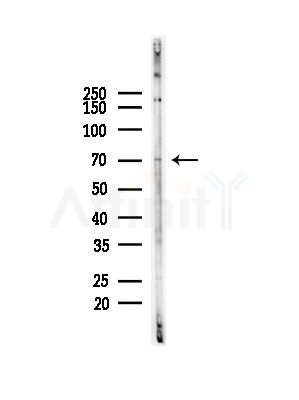 ADD3 Antibody - Western blot analysis of lysates from Rat lung, using ADD3 Antibody at 1/1000 dilution.