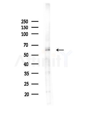 API-5 Antibody - Western blot analysis of lysates from Hela cells(heat-shock, 45min treatment), using API-5 Antibody at 1/1000 dilution.