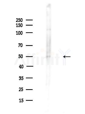 AVEN Antibody - Western blot analysis of lysates from A375 cells(LPS,4h treatment), using AVEN Antibody at 1/1000 dilution.