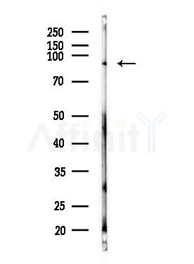 CDH16 Antibody - Western blot analysis of lysates from MDA-MB-231 cells(heat-shock,45min treatment), using CDH16 Antibody at 1/1000 dilution.