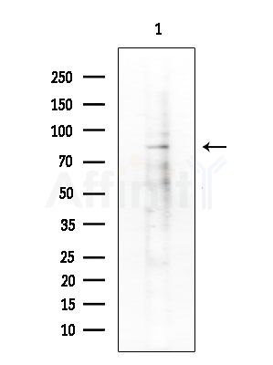 CDH18 Antibody - Western blot analysis of extracts from Rat testis, using CDH18 Antibody at 1/1000 dilution.
