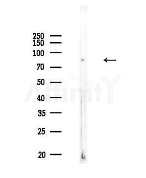 CDH7 Antibody - Western blot analysis of lysates from COLO205 cells, using CDH7 Antibody at 1/1000 dilution.