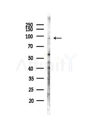 CDH9 Antibody - Western blot analysis of lysates from MDA-MB-231 cells(heat-shock,45min treatment), using CDH9 Antibody at 1/1000 dilution.
