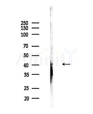 CADM2 Antibody - Western blot analysis of lysates from PC12 cells(LPS,4h treatment), using CADM2 Antibody at 1/1000 dilution.