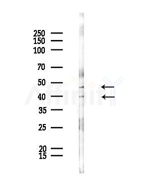 CADM2 Antibody - Western blot analysis of lysates from Rat brain, using CADM2 Antibody at 1/1000 dilution.