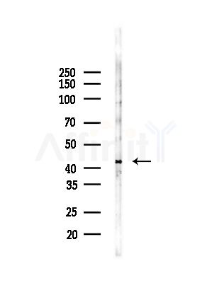 CADM3 Antibody - Western blot analysis of lysates from COLO205 cells(heat-shock,45min treatment), using CADM3 Antibody at 1/1000 dilution.