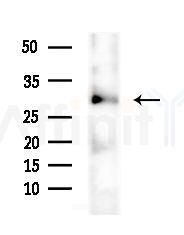 Cytochrome c-type Heme Lyase Antibody - Western blot analysis of extracts from Rat lung, using Cytochrome c-type Heme Lyase Antibody at 1/1000 dilution.